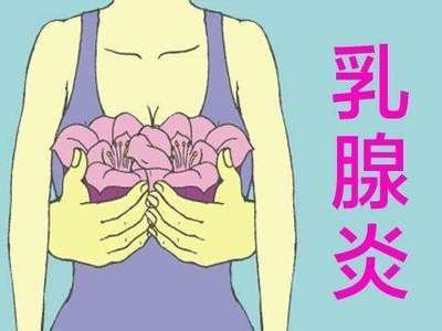 乳腺炎的预防